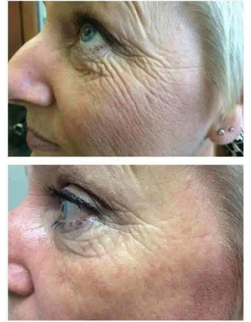 new packaging AgeLOC® Tru Face® Essence Ultra Uplifting Cream