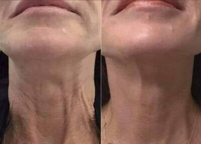 Firming Cream for the neck and down (Dermatic Effects)