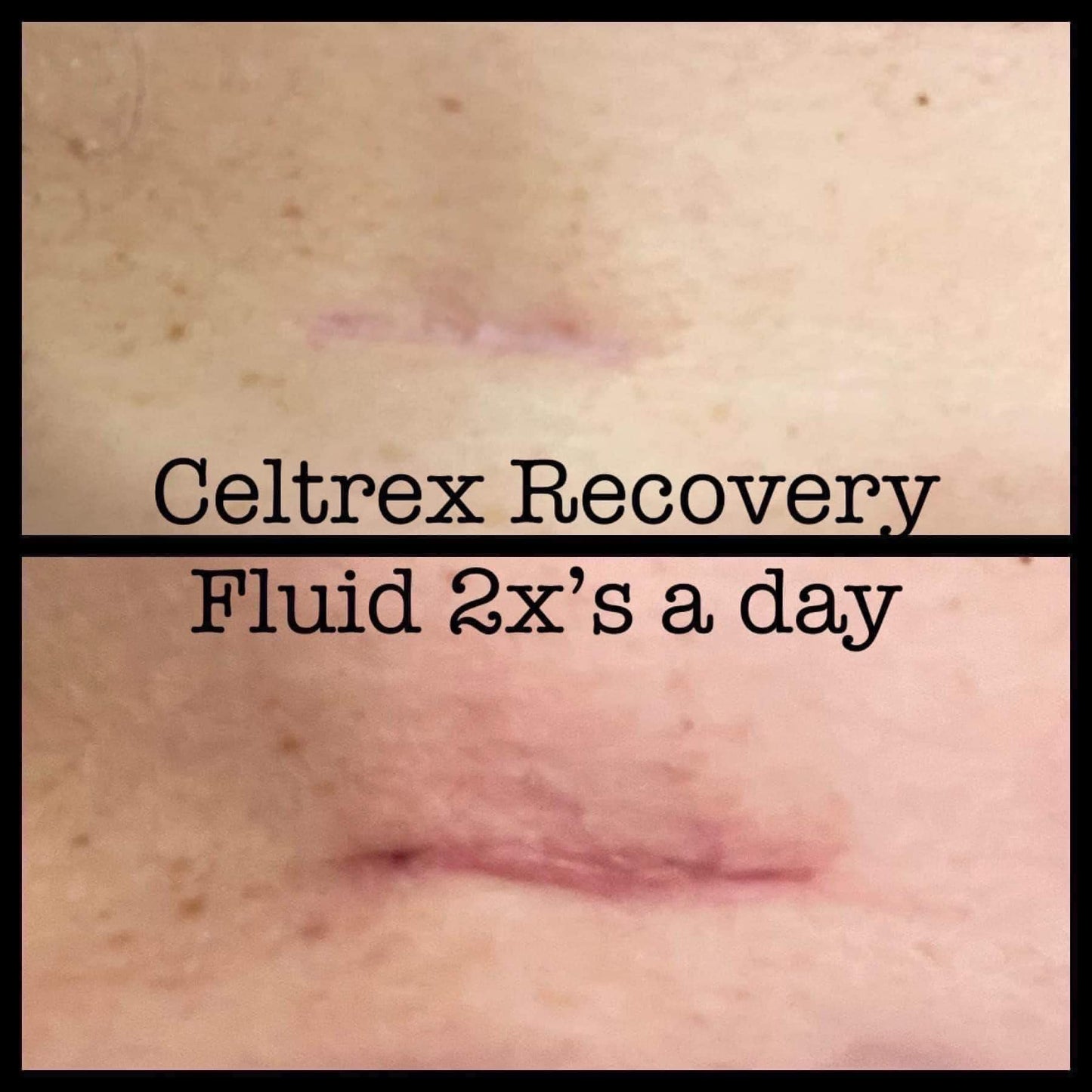 Celltrex Recovery Fluid