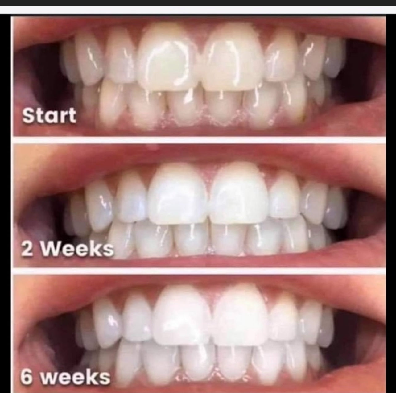 2 Pack of Whitening Toothpaste