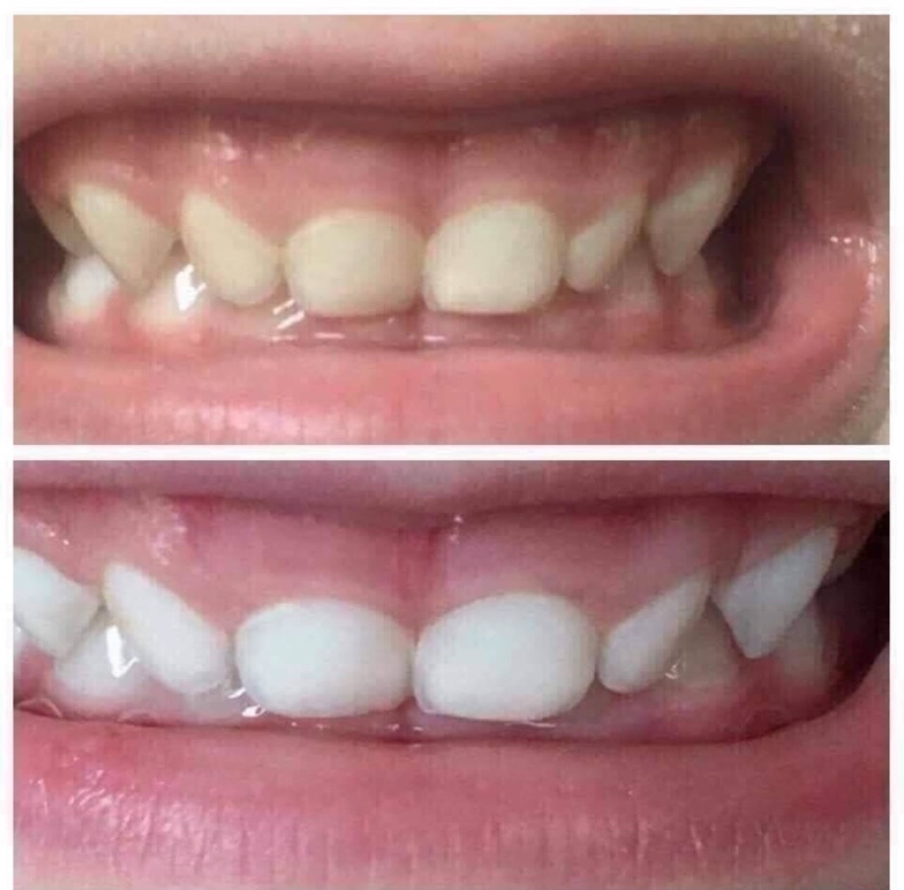 2 Pack of Whitening Toothpaste