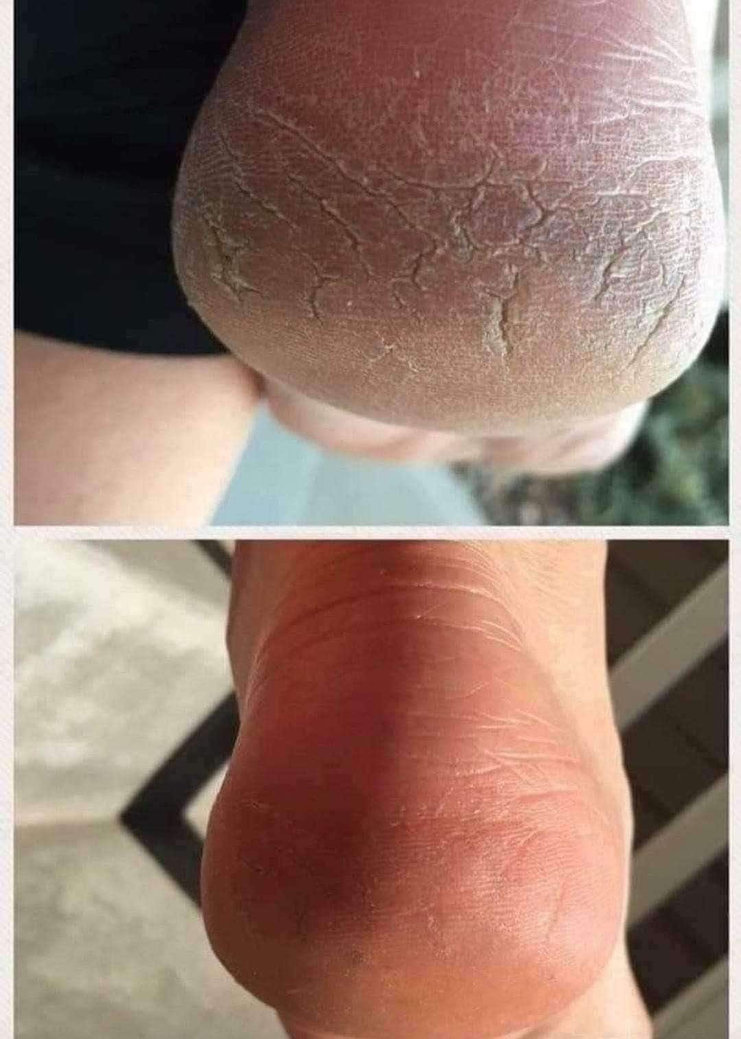 Sole Solution -Kick up your heels!