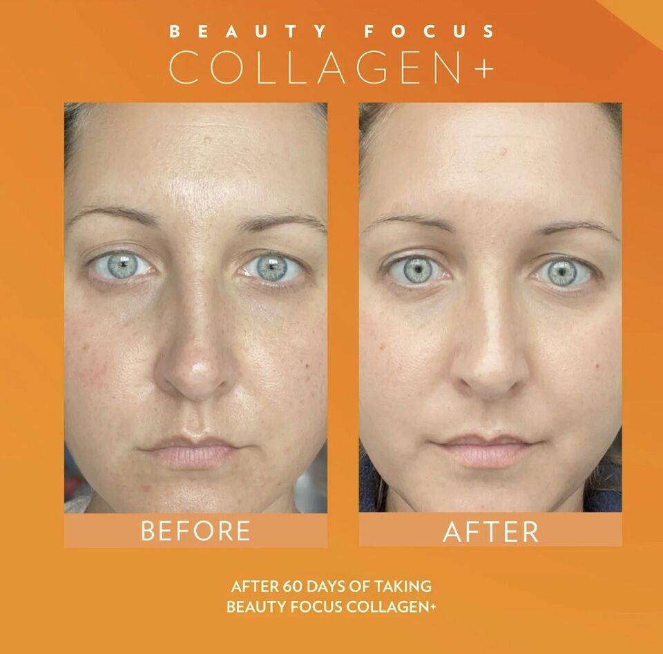 Beauty Focus™ Collagen+ SINGLE MONTH SUPPLY