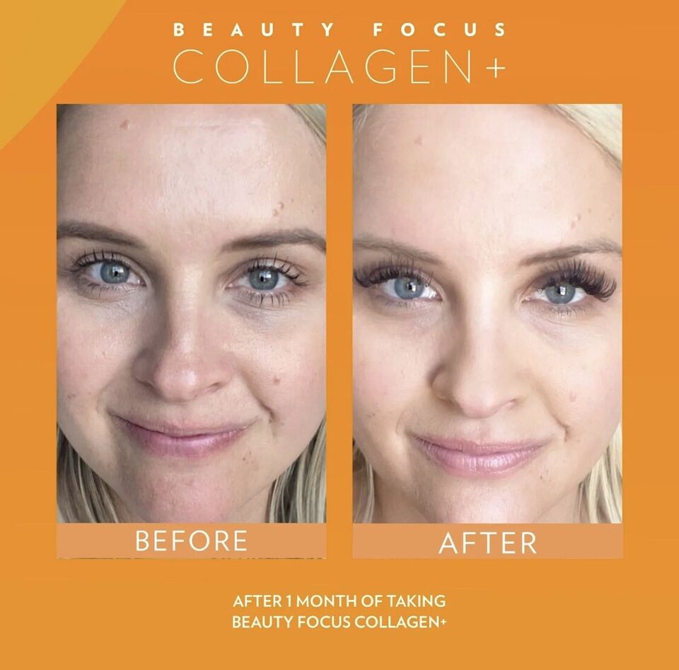 Beauty Focus™ Collagen+ SINGLE MONTH SUPPLY